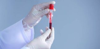 plasma therapy