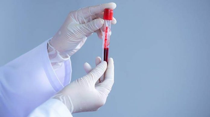 plasma therapy