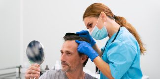 hair transplant